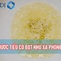 Nước Tiểu Bình Thường Có Bọt Hay Không